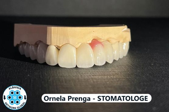 terapi dentare, kirurgji dentare, protetikë, kozmetikë dentare, ortodonci, implantologji